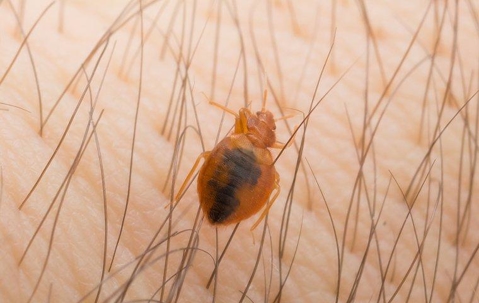 bed bug biting a denver resident